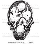Historical Vector Illustration of a Baby Twins in a Human Womb - Black and White Version by Al