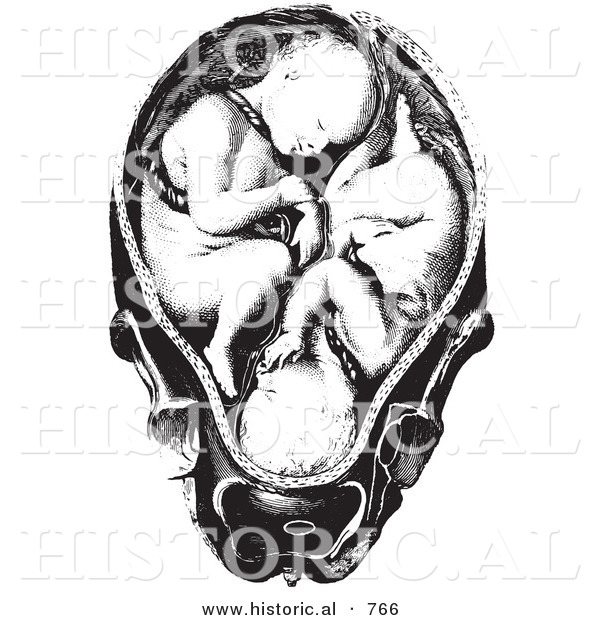 Historical Vector Illustration of a Baby Twins in a Human Womb - Black and White Version